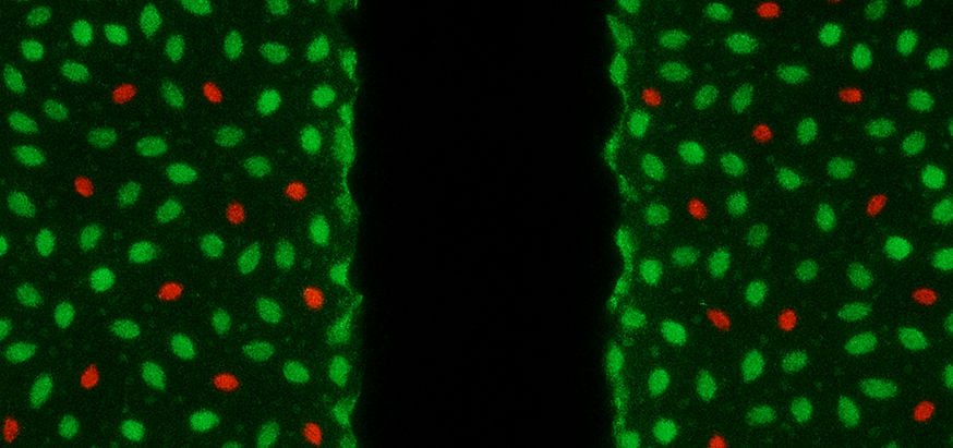 Complete Guide To Visualizing Cell Migration with Live Dead Staining