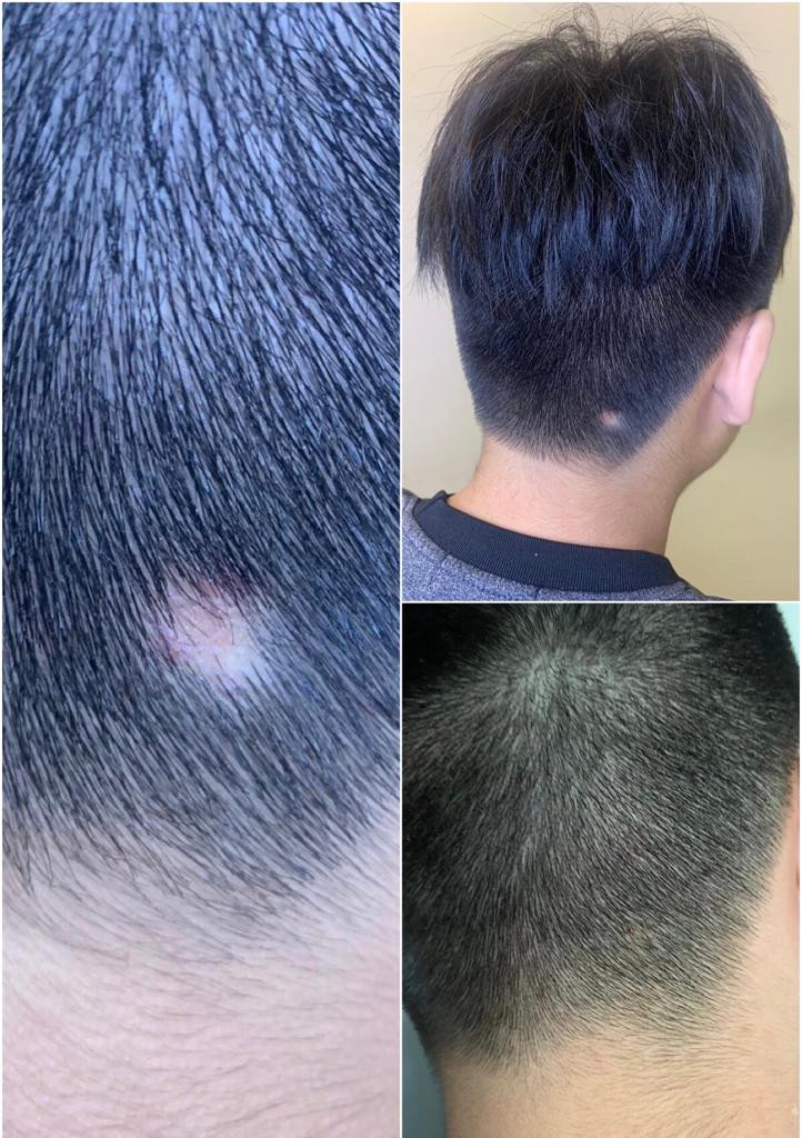 Before and After 60 days