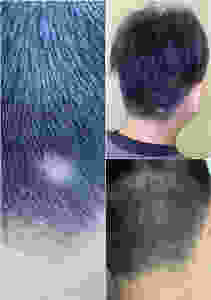 Before and After 60 days