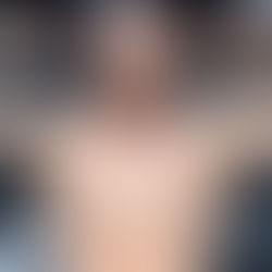 The Dark Side of a Fight Career: Shane Carwin's Heartbreaking Struggles and the Reality of Head Traum