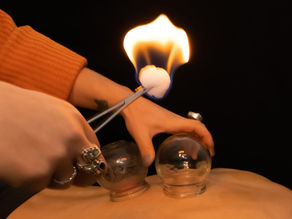 Other Chinese medicine modalities: Cupping, Gua Sha, Moxibustion, and Electroacupuncture