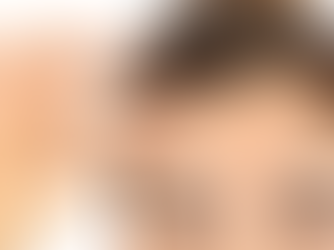 The Four Ways That Foreheads Age