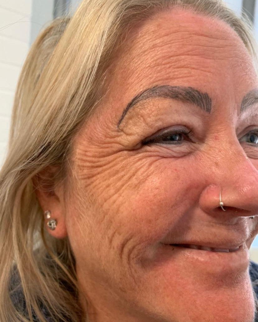 Serenbo Aesthetics Wrinkle Relaxing, Botox, Before and After February 2024. Image of client before wrinkle relaxing treatment at CV Makup Studio Cardiff Bay.