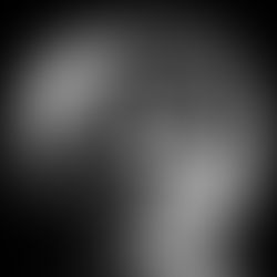 Magnesium Wheels Are the Future