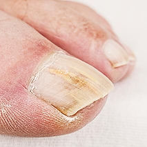 podiatrist castle hill