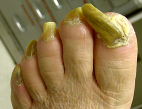 podiatrist western sydney