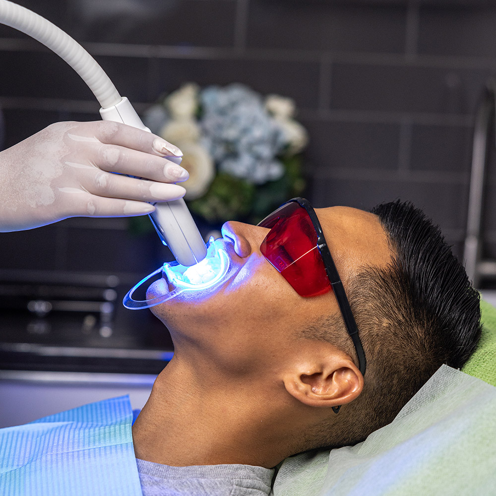 treatment-images-teeth-whitening-1.jpg