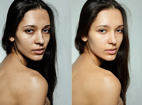 before-after-cosmetic-operation.jpg