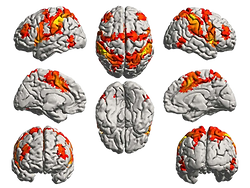 music-alzheimers-neurosciencenews.png