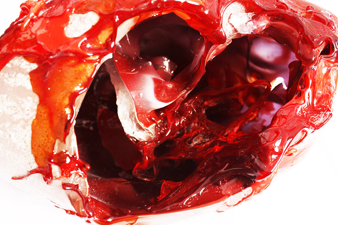 Sanguine detail