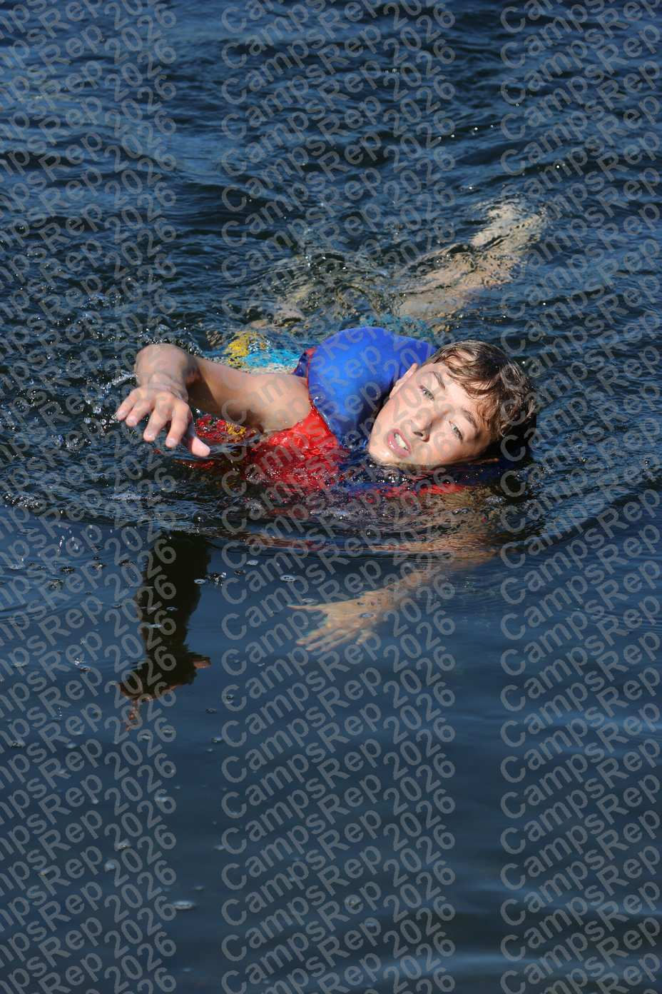 Photo-CR-AVN-S2-50