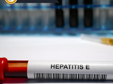 07/30/24 Public Health Education Topic: Hepatitis E