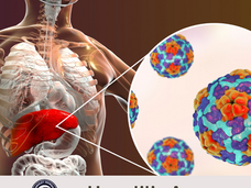 06/27/25 Public Health Education Topic: Hepatitis A