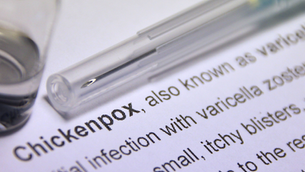 09/25/26 Public Health Education Topic: Chickenpox/Varicella