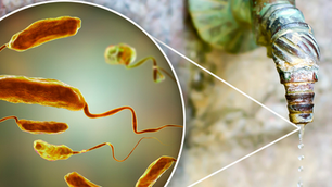 07/07/26 Public Health Education Topic: Cholera/Vibrio Cholerae