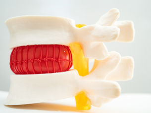 Sciatica Relief in Beaconsfield: How Advanced BioStructural Correction™ (ABC) Can Help