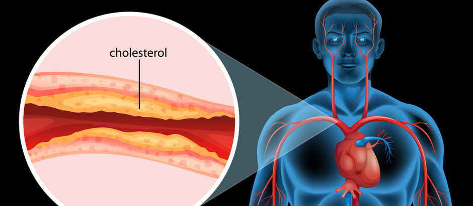 High Cholesterol? Look beyond statins and other cholesterol-lowering drugs