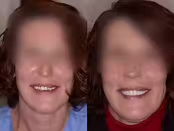 Real Customer Before & After