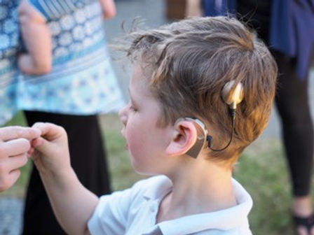 rafael sideways cochlear implant P629009