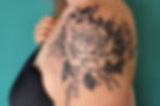 Covering Scar with Flowers