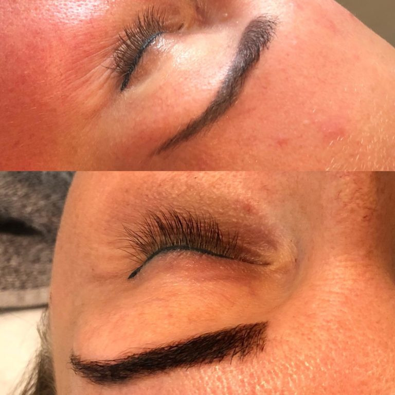 Kasia’s huid, voor (boven) en na (onder) aanpassing van haar verzorging en routine op basis van de SkinDNA™ uitslag.