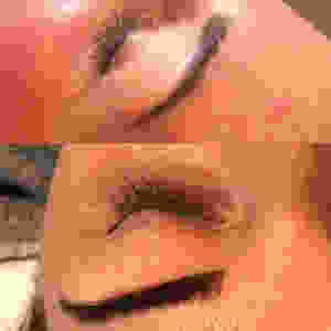 Kasia’s huid, voor (boven) en na (onder) aanpassing van haar verzorging en routine op basis van de SkinDNA™ uitslag.