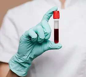 HbA1c-testi