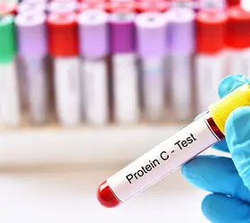CRP-testi