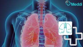 Enfermedad Pulmonar Intersticial en Adultos Mayores: Cómo Detectarla y Cuidar la Salud Respiratoria