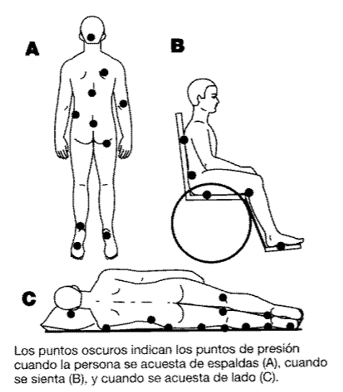 Ubicaciones comunes de los puntos de presión