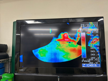 【気を科学する】原因不明のめまい、吐き気、動悸…交通事故後に潜む「バレ・リュー症候群」の影と、気鍼による根本治療