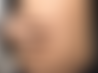 Caso Importado de Sarampión Detectado en Ciudad de México