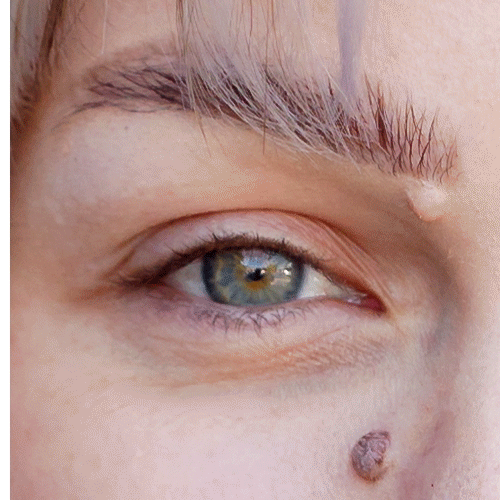 An eye of a before and after lash extensions application