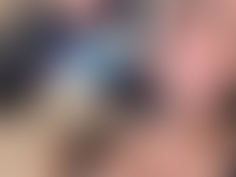 Kim Kardashian Xerf Treatment