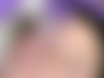 Potenza RF Microneedling