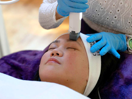 XERF RF Skin Tightening in Victoria BC