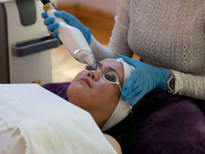 Xerf RF Skin Tightening Victoria, BC