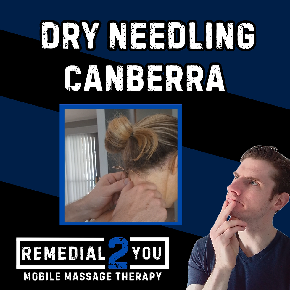 Dry Needling Canberra