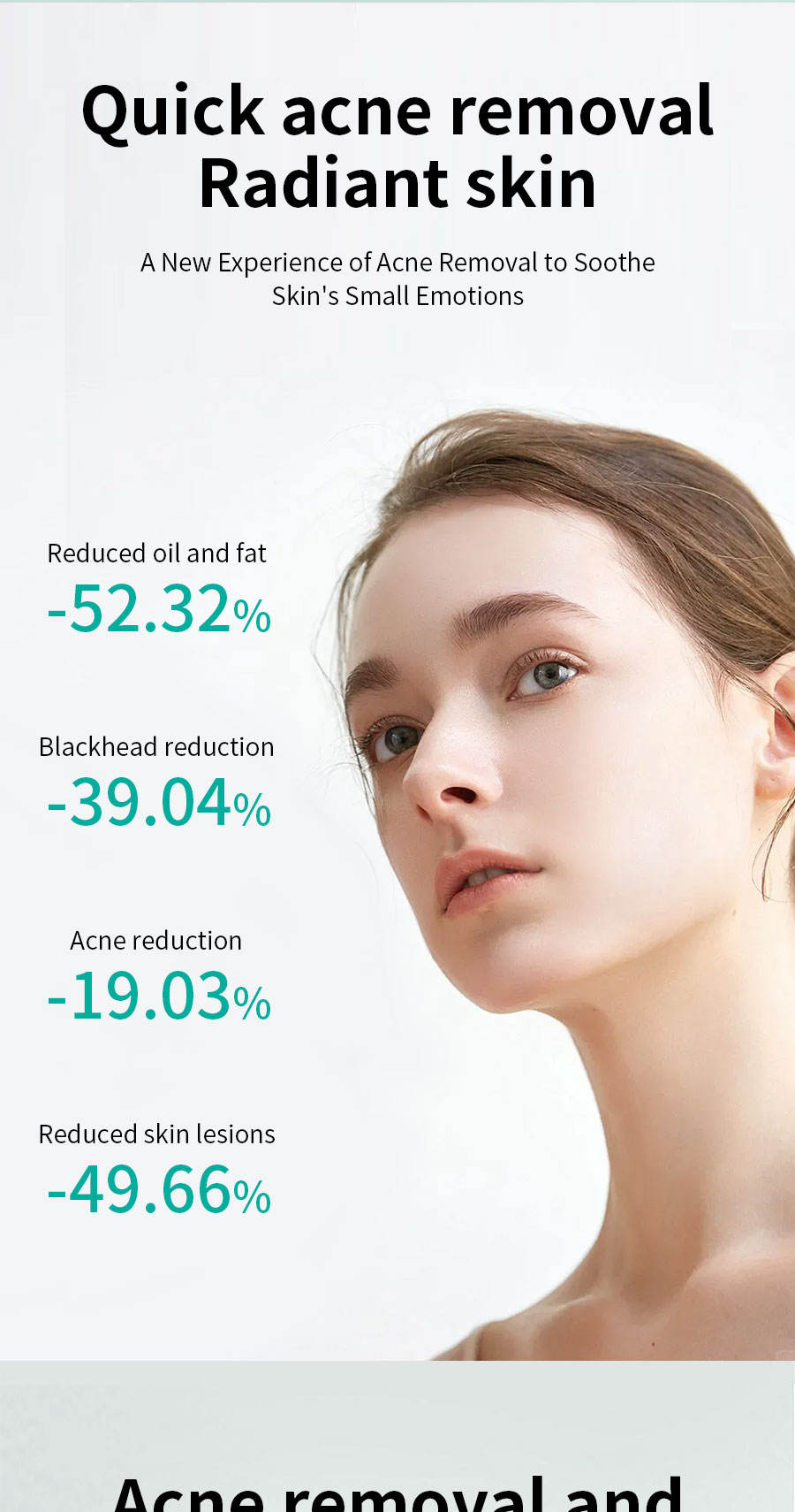 Thumbnail: Aesthetic Acne treatment 