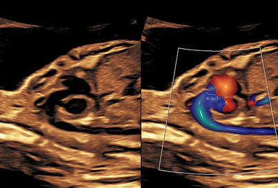 fetal-cardiac-course-700x450.jpg