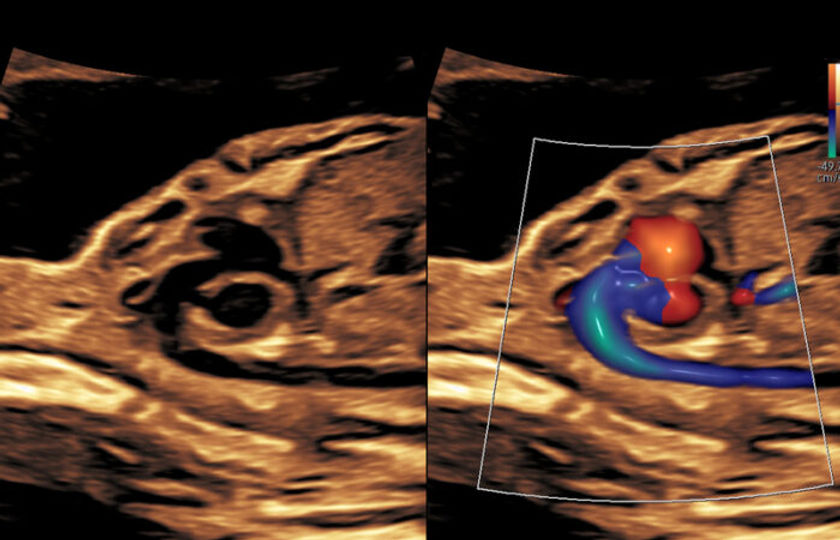 fetal-cardiac-course-700x450.jpg
