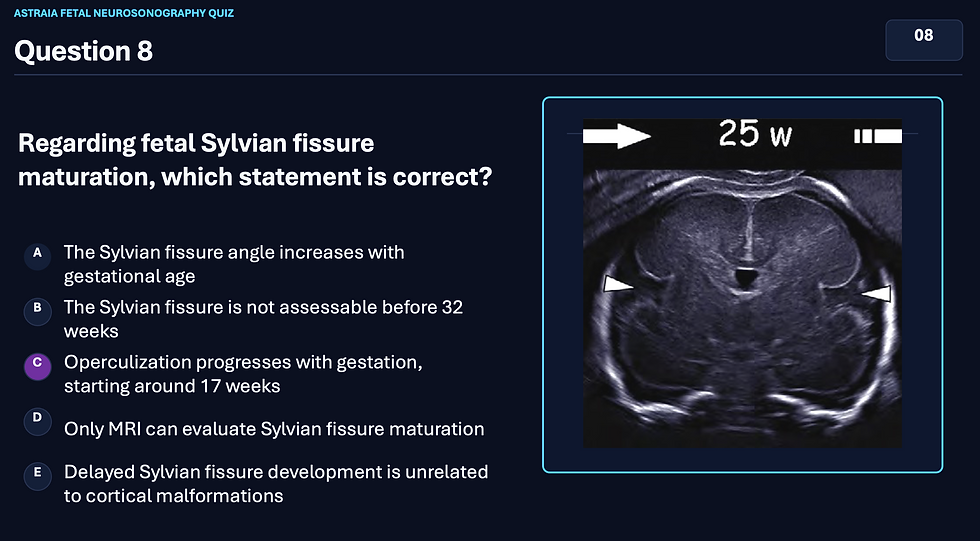 Astraia Software's Fetal Neuro Challenge, Question 8