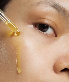 treating dull, dry, and sun damaged skin with mesotherapy