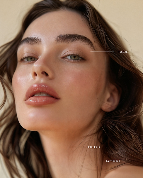 RF microneedling for skin tightening