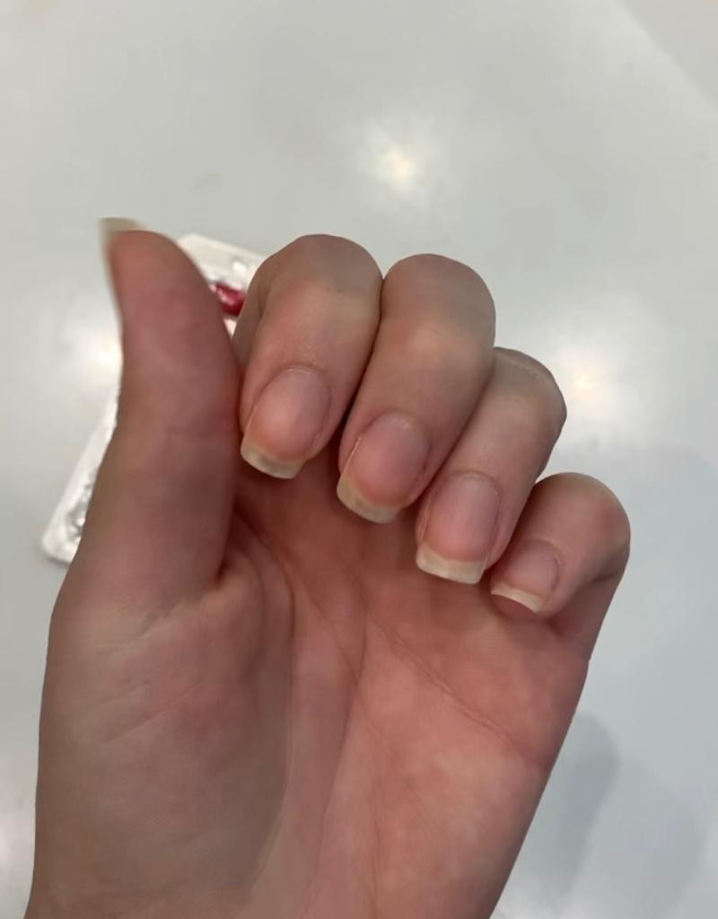 resultado tratamento onicut unhas fortes e longas