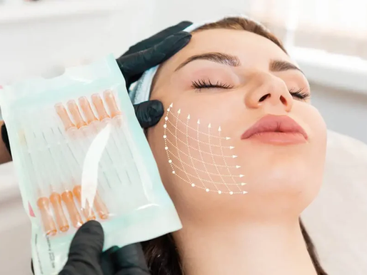 Smooth PDO threads in Parkland FL