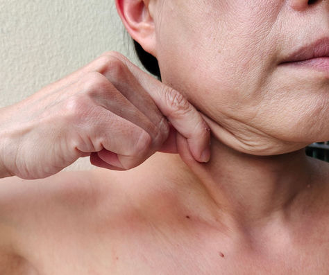 Combat Skin Laxity on the Face and Body at Blue Iris Medical Aesthetics in Parkland, FL