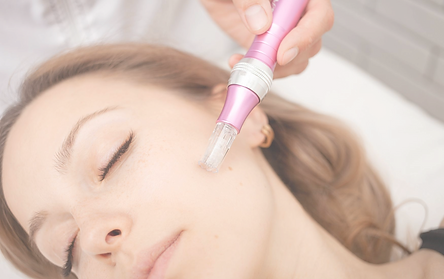 A woman's face with closed eyes during Microneedling or Microchanneling treatment