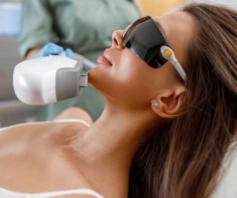 Everything You Need to Know About IPL Photofacials