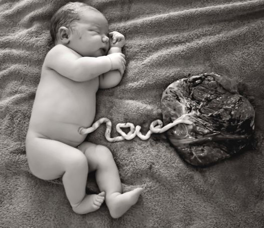 Five Things You Should Know About Your Baby S Umbilical Cord